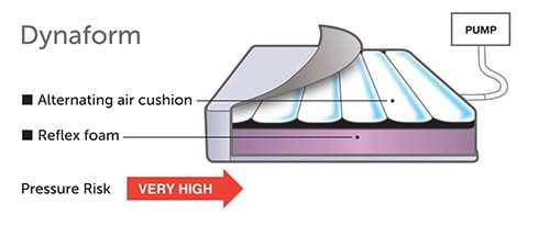Dynaform